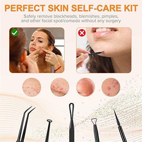 FishOaky Blackhead Remover Tool, Extractor Puntos Negros, 5 PCS Acero Inoxidable Acné Quita Espinilla Pin Spot Pimple Popper Pinzas Kit para Manchas Blancas, Manchas de Acné con Manchas