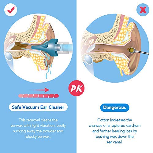 Fovel limpiador oidos cera Eliminación de cera Eliminar cera oidos Kit Limpiador de Cera de Oídos Limpiador De Oidos para bebés jóvenes y adolescentes adultos