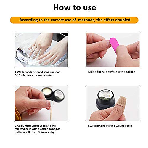 Fungus Stop,Crema Hongo Uñas Tratamiento,Anti Hongos De Uñas,Crema Tratamiento anti-hongos en las uñas,Tratamiento anti hongos de uñas,Apto para dedos y pedicura