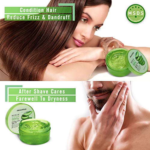 Gel de aloe vera orgánico de 300 ml: crema hidratante natural AKIMO, crema hidratante para el vello corporal, cuidado de las quemaduras solares, cicatrices reparadoras, calmantes y antiinflamatorias