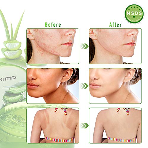 Gel de aloe vera orgánico de 300 ml: crema hidratante natural AKIMO, crema hidratante para el vello corporal, cuidado de las quemaduras solares, cicatrices reparadoras, calmantes y antiinflamatorias