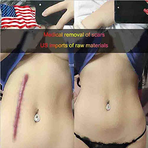 Gel de silicona para cicatrices, clínicamente probado para ayudar a suavizar, suavizar y aplanar las cicatrices