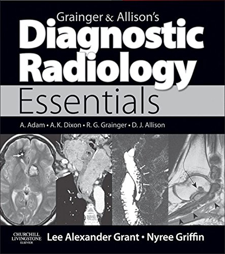 Grainger & Allison's Diagnostic Radiology Essentials E-Book: Expert Consult: Online and Print (English Edition)