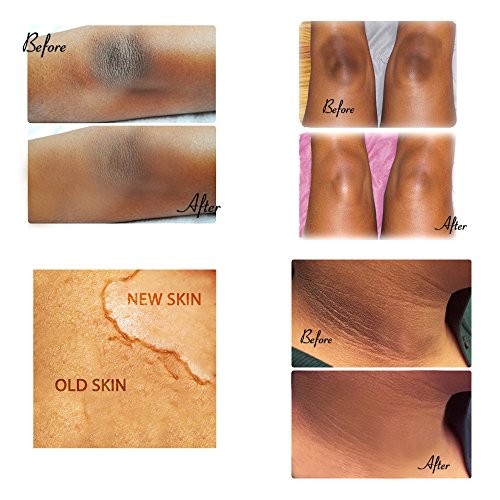 Guantes exfoliantes corporales de Kessa marroquí, calidad premium