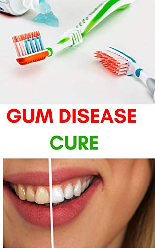 Gum Disease Cure: How cure Periodontal Disease, Gum Disease, Gum Infection, Gingivitis treatment,Natural Remedies. (English Edition)