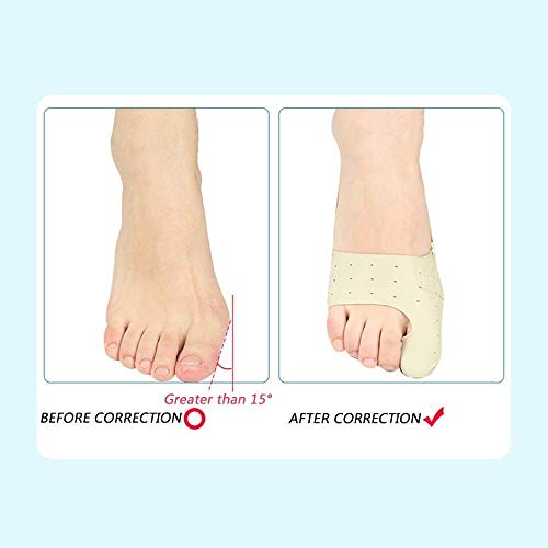 Hammer Corrector de juanetes, juanetes férulas juanetes Pads, Valgus El tratamiento del juanete Calcetines protector, transpirable protector durable, dedo gordo del pie enderezadora alivio del dolor f