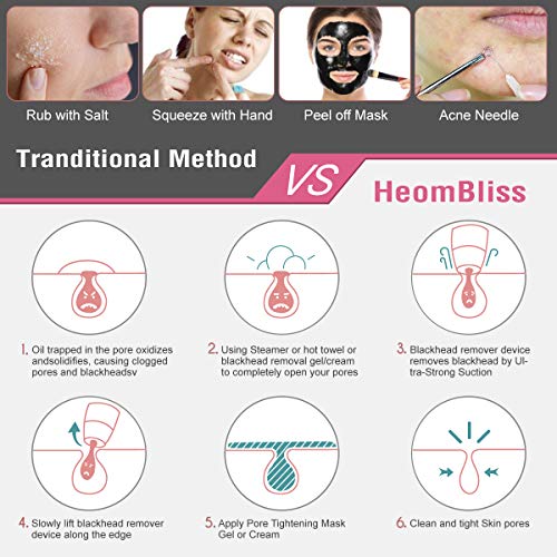 HeomBliss Limpiador de Poros Electrónico Limpiador Puntos Negros, Eliminador de Puntos Negros 5 Cabezales 5 Velocidades, Extractor de Puntos Negros con pantalla LCD