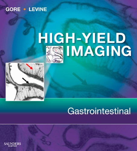 High Yield Imaging Gastrointestinal E-Book: Expert Consult - Online and Print (High Yield in Radiology) (English Edition)