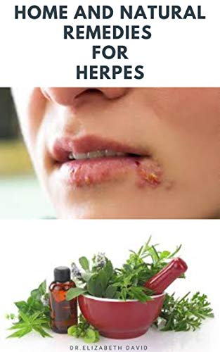 HOME AND NATURAL REMEDIES FOR HERPES (English Edition)
