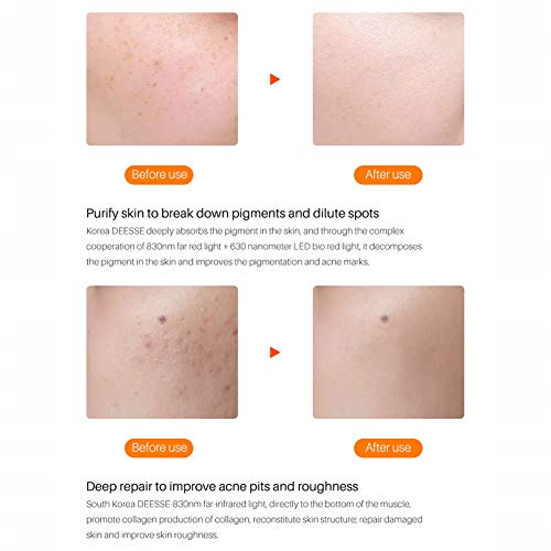 HWZZ 7 Colores LED Máscara Rejuvenecimiento De La Piel Instrumento De Belleza Rojo Azul Luz Instrumento De Belleza Espectrómetro Casero con Máscara para El Cuello,Blanco