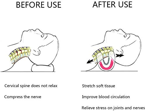 Innovative Neck Stretcher,Portable Neck Support Pillow for Relief of Neck Pain & Stress, Improve Sleep Quality,for Side Sleepers, Back and Stomach Sleepers (Grey)