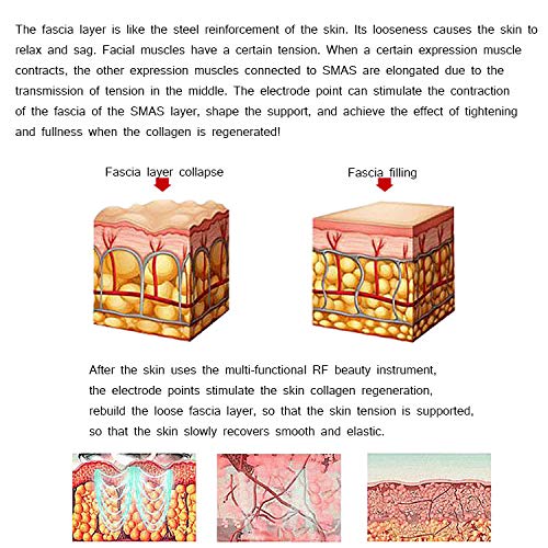 Instrumento De Belleza Facial Y Cuello,Instrumento De Belleza Facial De Radiofrecuencia,masajeador De Ojos Sónico Calentado,masajeador De Piel,Elimina Las Arrugas De Las Ojeras,Gris