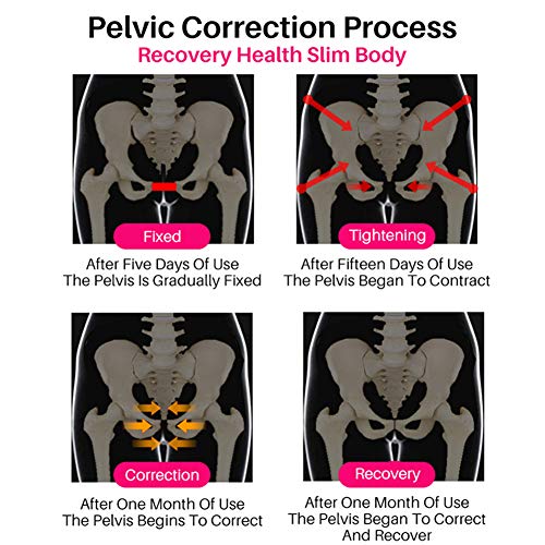 JMung Faja Cinturon Postparto Reductora Sacroiliaco Cintura Moldeadora para Mujer Maternidad Recuperación, Transpirable Elástico Postpartum Soporte Pélvico Cinturón Faja,Negro,L