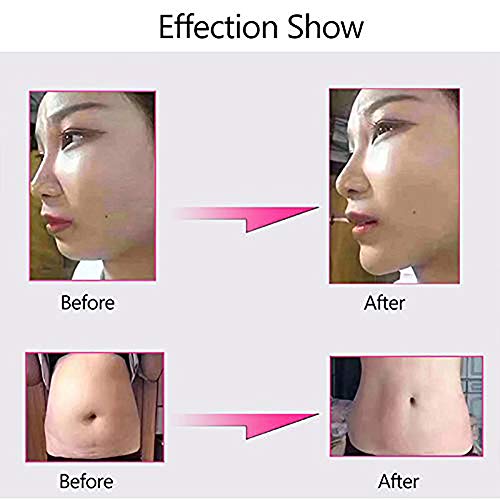 JYZ Hyaluron Pen,Maquina de Belleza para la eliminación de Arrugas Labio de elevación Pluma de ácido hialurónico Atomizador con 5 Piezas Ampolla Cabeza (0.3ml)