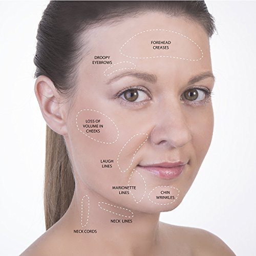 Kit de Masaje Facial - Ventosas de Silicona - Juegos de Terapia de Ventosas - Copas Anticelulíticas - Reductor de Barbilla Doble Perfecto - Terapia de Cara de Sandine (Rosa 5 piezas)