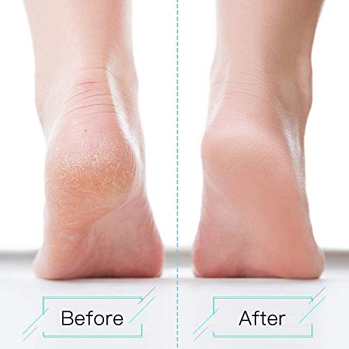 Kit de Pedicura, TAIYUNWEI 28 en 1 Profesional Kit de Herramientas de Pedicura Conjunto de Pie de Acero Inoxidable Escofina de Pie Remover la Piel Muerta Para el Cuidado de los Pies en Hogar