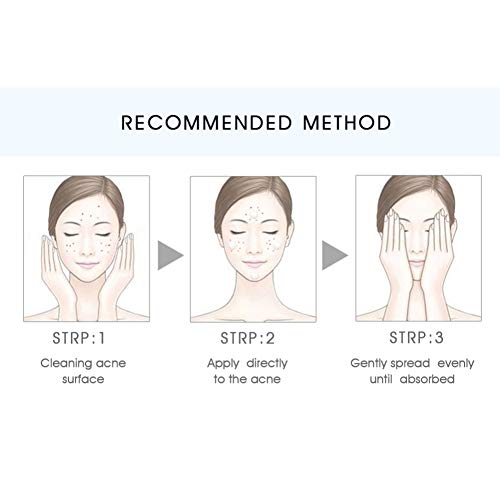 La crema reparadora para el acné Onkessy reduce rápidamente las manchas Eliminar las espinillas Reducir los poros Antiinflamatorio Crema anti-acné