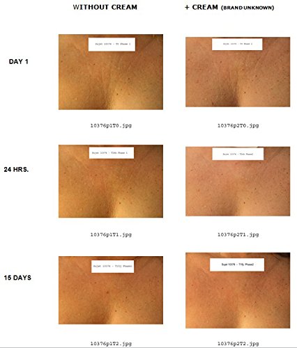 La Decollette Multi Animal, la solución innovadora de Obtener y Mantener una Agradable, Suave y Apretado Escote! El Sujetador Anti-Arrugas, antienvejecimiento Durante la Noche