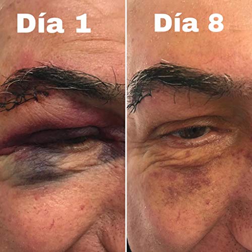 Licotriz Olivolea Crema Cicatrizante y Regeneradora de la piel, Tratamiento Cicatrices, Lesiones Cutáneas por Láser, Quemaduras, Dermatitis y Cortes