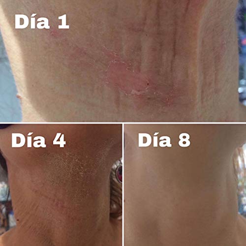 Licotriz Olivolea Crema Cicatrizante y Regeneradora de la piel, Tratamiento Cicatrices, Lesiones Cutáneas por Láser, Quemaduras, Dermatitis y Cortes