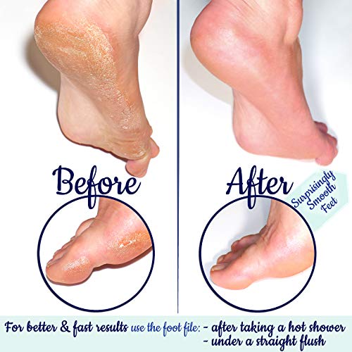 Lima de Pies de Cristal Checo - Lima de Callos Delicada, Pedicura y Spa, Remoción de la Piel Agrietada, Cuidado Profesional del Talón y los Dedos del Pie, Superficies Incisas en Diferentes Granos