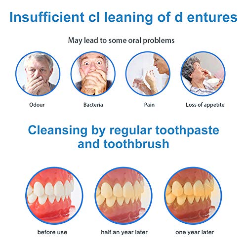 Limpiador de Dentadura, Tabletas Limpiadoras para Prótesis Dentales, Tabletas De Limpieza Dental, Tabs Tabletas Limpiadoras Efervescentes, Elimine El Sarro Sebelde Y Las Manchas 30 pestañas