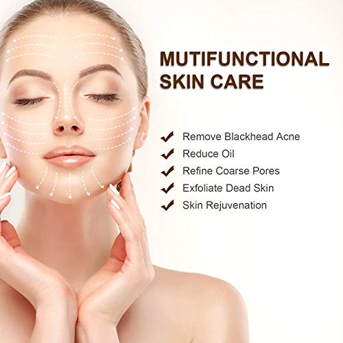 Limpiador de Poros 5-In-1 Succionador de Puntos Negros Quita Espinillas y Puntos Negros con USB Quita Puntos Negros Eliminación de Espinillas y Acné (A1)