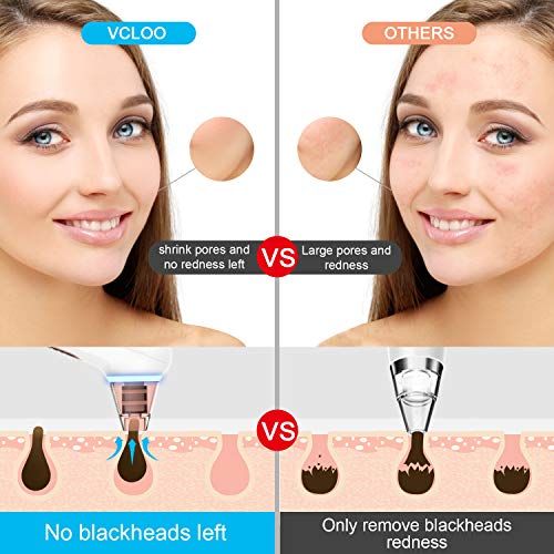 Limpiador de Poros - Extractor de Puntos Negros Limpiador Facial Blackhead Remover Eliminador Puntos Negros Electrónico USB Recargable 4 Cabezales y 3 Modos Removedor Puntos Negros