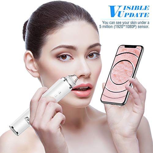 Limpiador de Poros Succionador de Puntos Negros Limpiador Facial Blackhead, Iimpiador de Poros Facial Kit Herramienta de Succión de Espinillas Recargable USB