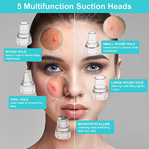 Limpiador de Poros, Succionador de Puntos Negros USB Recargable, Extractor Puntos Negros Limpiador Facial 5 Cabezales y 3 Modos para Espinillas y Acné, Aspiradoras con pantalla