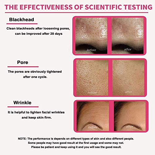 Limpiador Facial Ultrasonico, 3 Modos Skin Scrubber Peeling facial Poros Limpiador de la piel Dispositivo de belleza para el Hogar