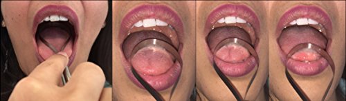 Limpiador linguales - puro acero inoxidable - Hecho en Alemania LinguafreshONE - Pure Stainless Single Version - Limpiador Lingual - reciclable