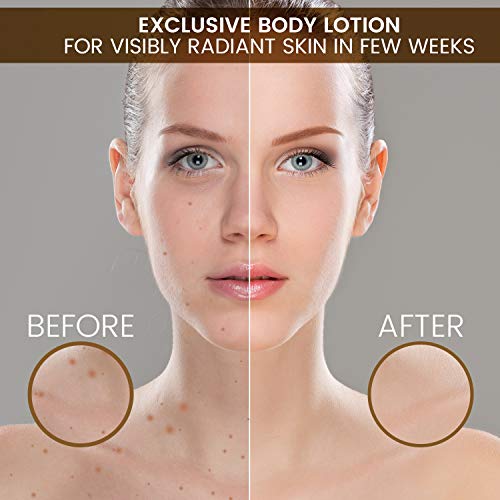Loción Corporal Antimanchas 500 ml – Loción Blanqueadora, Despigmentante, Aclaradora y Hidratante Para Pieles Sensibles, Con Vitamina E y Camomila, Para Hombres y Mujeres, Sin Parabenos