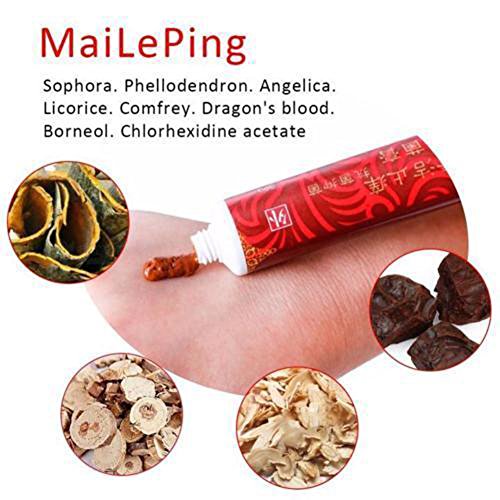 Lovelop 2018 New Magic Crema para tratamiento de venas varicosas Magic Varicose Veins Treatment Cream