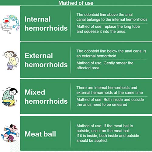 Lucoss Crema de Alivio Hemorroides Pomada para Hemorroides Crema Gel Crema de Alivio Rápido Fórmula Curativa Natural para Quemar Picazón,Dolor,Sangrado e hinchazón