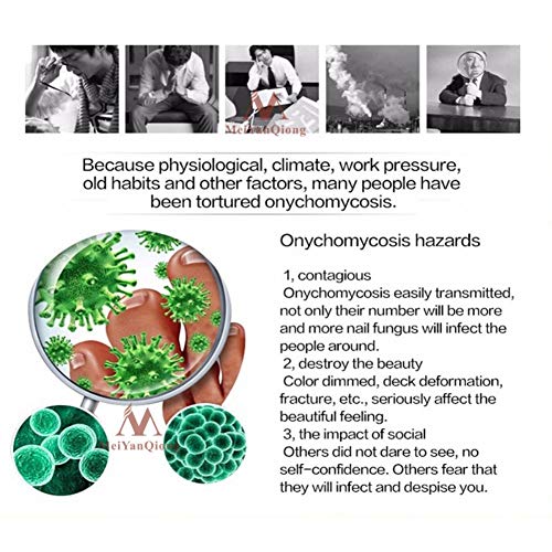 Lucoss Reparadores de Uñas Tratamiento de Hongos Uñas y Pies, Crema para Antihongos Uñas,Eliminación Quitar Onicomicosis