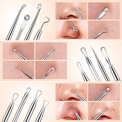 Lurrose - Kit de utensilios para eliminar puntos negros, de acero inoxidable profesional, extractor de acné, espinillas, pinzas, para eliminar puntos blancos, 8 utensilios