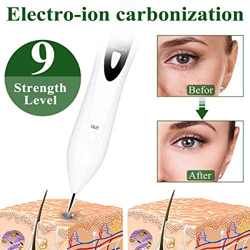 Manchas Cara Eliminación, Pluma de Eliminación de Mole, Spot Eraser Pro, Mole Remover Pen, Pluma de Pecas para Manchas, Pecas, Tatuajes, Verrugas y Mole, Con Pantalla LCD y Agujas Reemplazables