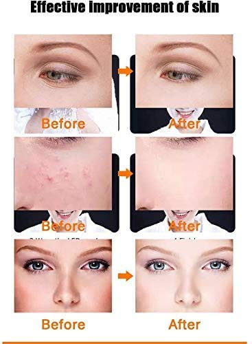 Máscara facial antiacné para terapia con luz led, terapia de fotones FT350 contra el acné, para el rejuvenecimiento de la piel, reduce granos e inflamaciones con luz azul/roja/naranja