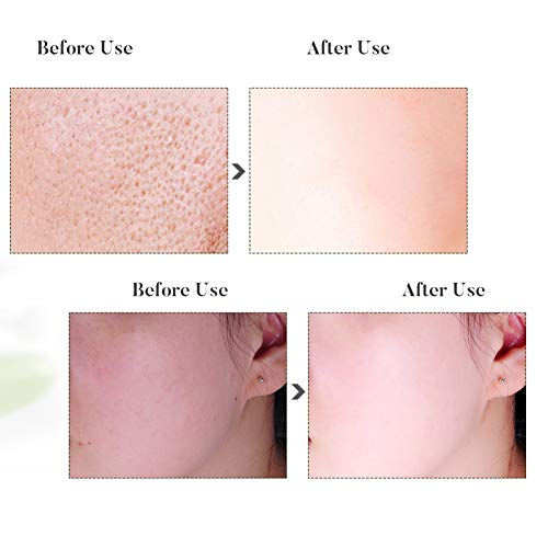 Mascarilla de arcilla cúrcuma, Mascarillas Hidratantes, Mascarilla exfoliante facial, limpieza profunda y refinación de poros, Reduce puntos negros, espinilla y grano de acné