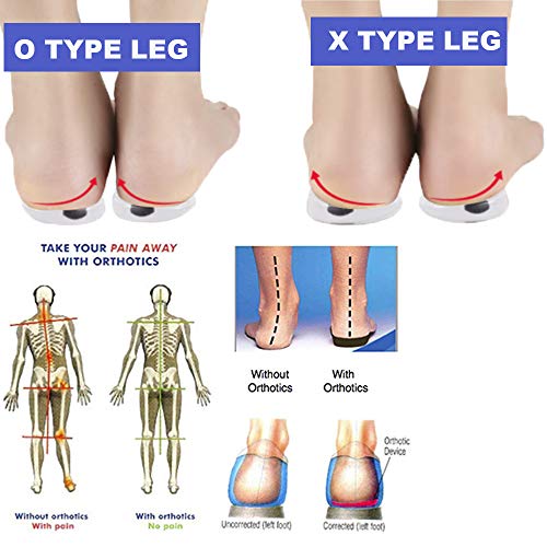 Mcvcoyh Plantillas ortopédicas para corregir las inserciones de zapatos de pie tipo O/X, almohadillas de tacón magnético integradas para alineación de pies, dolor de rodilla y piernas de lazo, 2 pares