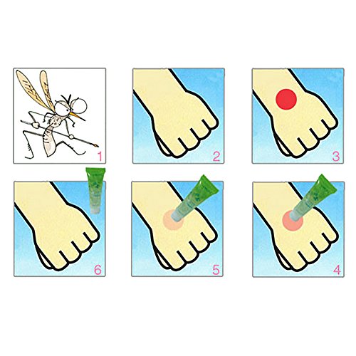 Moresave Gel de aloe vera contra el acné hidratante antiinflamatorio contra picaduras de mosquitos reparación de daños en la piel