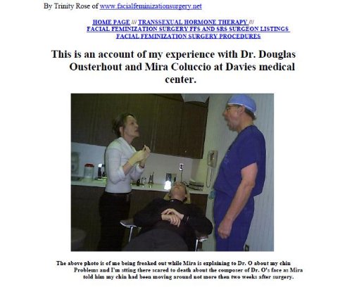 My Facial Feminization Surgery FFS experience with Dr. Douglas Ousterhout and Mira Coluccio at Davies medical center and corrections done by Dr. Mark Zukowski ... and transgendered (English Edition)