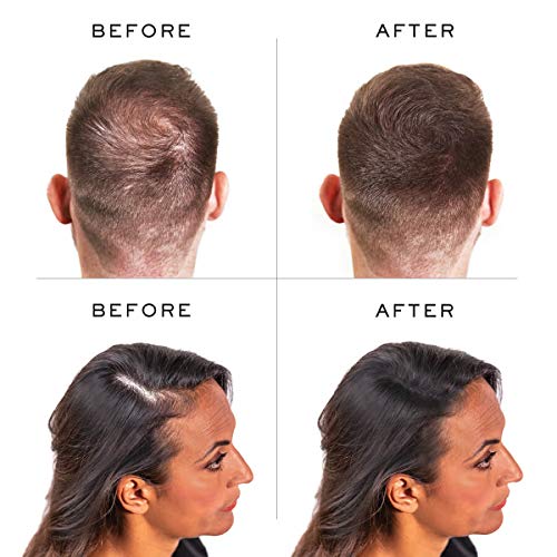 Nanogen Fibras Capilares Queratina: Castaño Claro 15 gr.