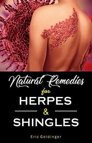 Natural Remedies For HERPES & SHINGLES : The Complete Guide (English Edition)