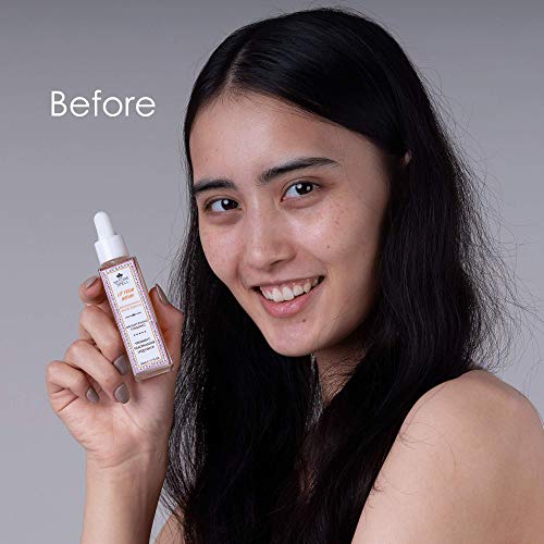 Nature Spell Suero facial iluminador con vitamina C y niacinamida 30 ml - 100% vegano, fabricado en el Reino Unido - Ilumina y suaviza la piel, minimiza los poros dilatados