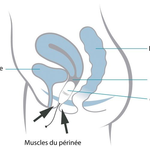 Neen Aquaflex - Aparato ejercitador para musculatura del suelo pélvico