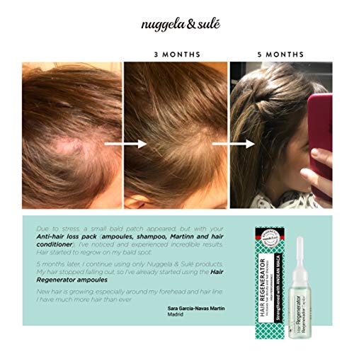 Nuggela & Sulé Tratamiento Regenerador Capilar, 4udsx10ml.- Alto Rendimiento. Ingredientes activos que estimulan el crecimiento del cabello, aumentan su grosor y densidad. Finalista MEJOR PRODUCTO.