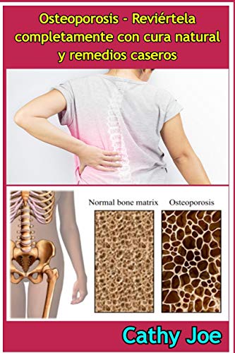 Osteoporosis - Reviértela completamente con cura natural y remedios caseros
