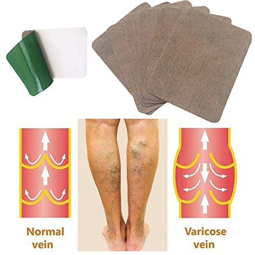 Parche Curación Venas Varicosas, Flebitis Alivio La Medicina Herbaria China Natural, Yeso Para El Tratamiento Varices Las Venas, Flebitis Alivio Para Las Piernas Hombro La Cintura Del Cuello (3BOX)